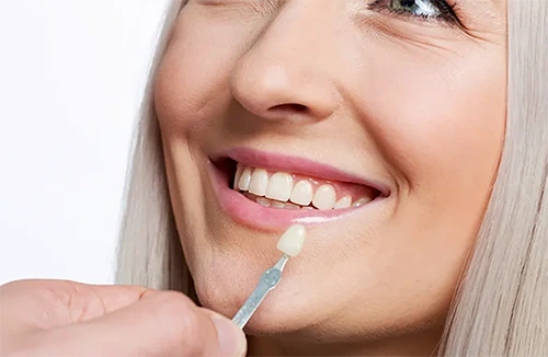 Metal Free Dental Crowns