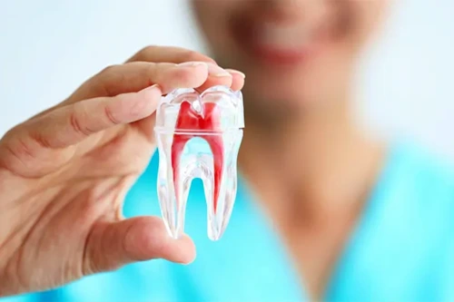Root Canal Therapy